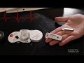 Heart Monitors and Their Evolution