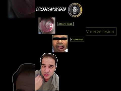 Anatomy Video Shots: RULE OF 17