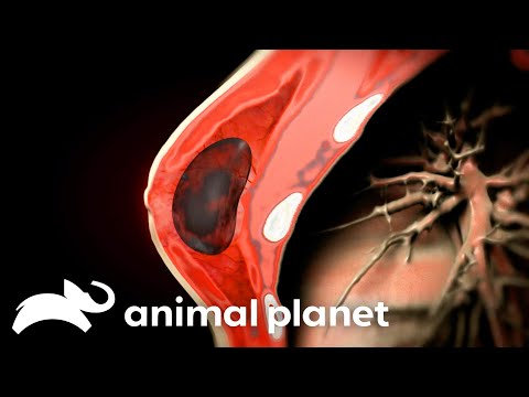 Infected Breast Implants Causes A Woman's Body to Shut Down | Monsters Inside Me | Animal Planet