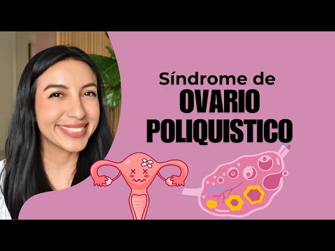 SÍNDROME de OVARIO POLIQUÍSTICO: así se CURA