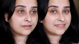Get rid of pigmentation with L’Oréal Paris Glycolic Bright Serum and Eye Serum