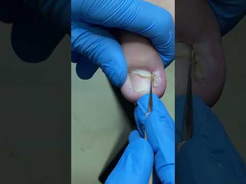 Satisfying pedicure video!  #shorts #manicuresvideos #pedicure #ASMR