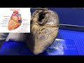 Cardiac Anatomy and Procedures