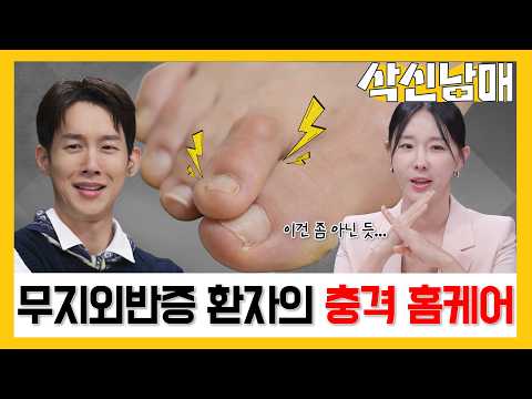 [삭신남매]🦶🏻발가락 교정기 끼고 양말에 묵주알까지?! 30년 앓은 무지외반증 악화시킨 충격적인 홈케어⚡️