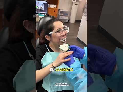 Qué hace que una impresión dental sea difícil de quitar😮
