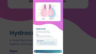 WORLD PEDIATRIC SURGERY DAY