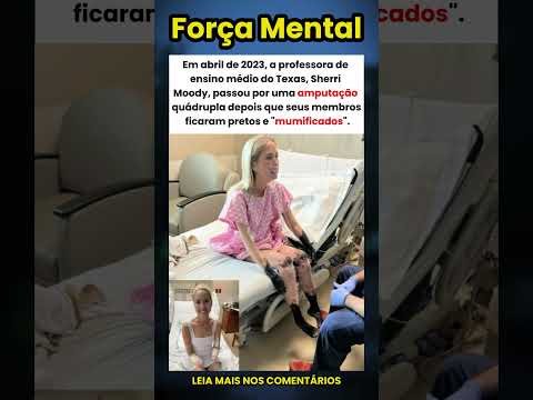 Professora tem membros amputados após infecção grave 😲🙏