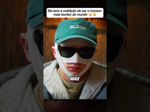 Ele tem a maldição de ser bonito demais