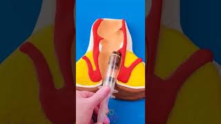 Say Goodbye to Pain: How Surgeons Fix It ✂️🙏