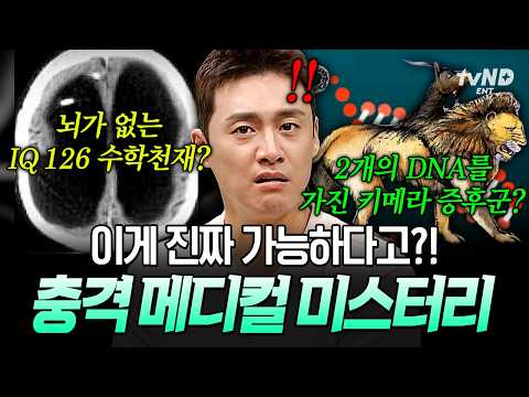 [#프리한19] 쌍둥이가 한 명으로 태어났다⁉️ 의학계에서도 풀지 못한 인체의 기적