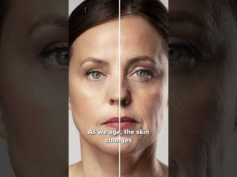 Deep Plane Facelift video 3