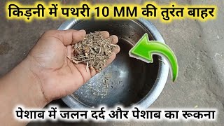 पथरी चाहे कितना भी बड़ा हो,पेशाब के रास्ते बाहर निकल जायेगा। गुर्दे की पथरी का घरेलू नुस्खा।