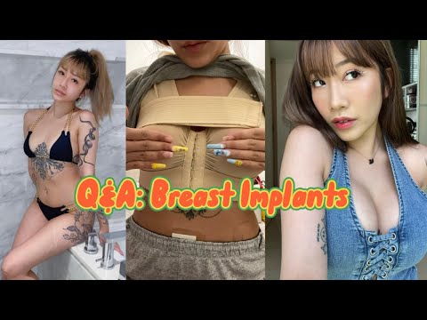 What you need to know before getting Breast Implants!