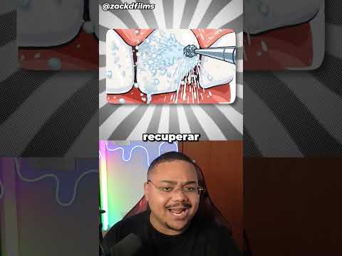 Consertando um dente lascado 😁 @zackdfilms