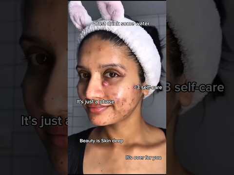 “Clear Skin Transformation – Acne ➜ Glow”