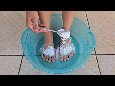 Coloquei Bicarbonato nos Pés e olha oque aconteceu!!