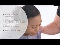 Understanding Severe Allergic Reactions