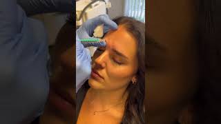 DAXXIFY Works FASTER than BOTOX & Can LAST LONGER! #injection #beauty #shorts