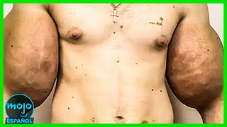 ¡Top 10 de Cirugías Plásticas que SALIERON MAL!