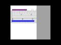 Understanding Ruler Measurements and Fractions