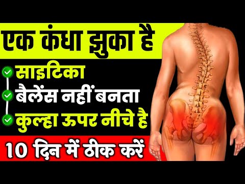 कुल्हा ऊपर नीचे हुआ तो साइटिका जरूर होगा|Uneven Hips Exercises In Hindi|Sciatica Hip Pain  Relief