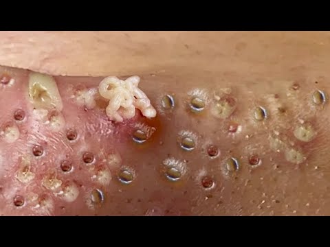 Most Satisfying and Relaxation with An Spa Video #2288