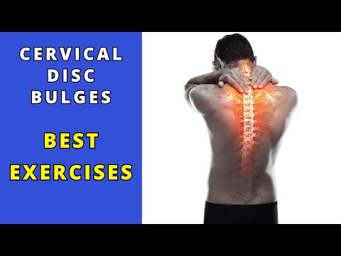 Cervical Disc Bulges best rehab exercises.