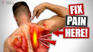 The REAL Fix For Rhomboid Pain [Not What You Think!]