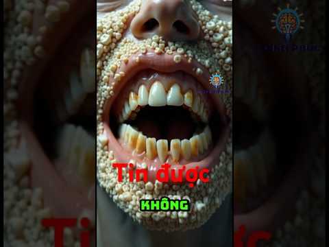 tiên răng trông thế này ư 😱😱