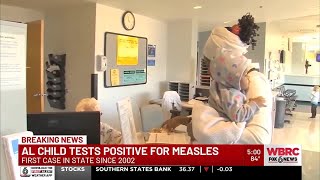 Alabama child tests positive for measles for the first time since 2002