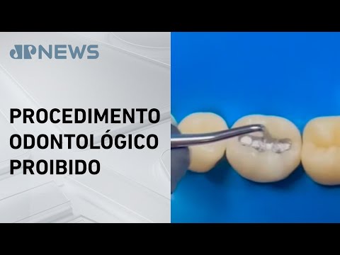 Europa proíbe uso de amálgama dentário em 2025