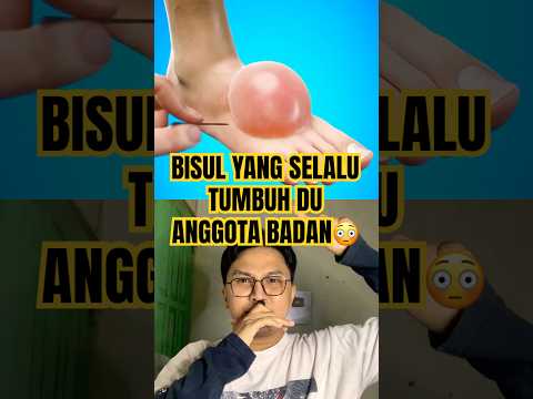 Bisul yang selalu tumbuh😳 #feet #satisfying #funny #slime #thebaldheadnthedreadpodcast