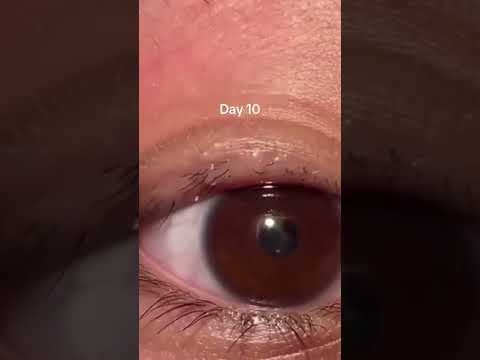 How to recover lashes? ✨