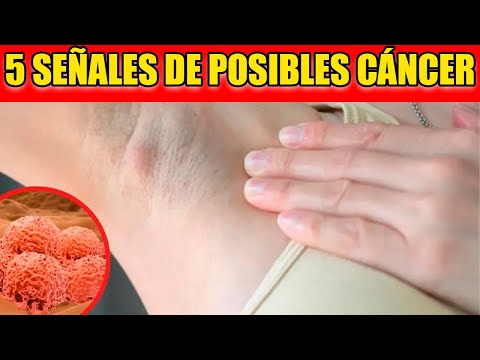 5 señales de que está creciendo un cáncer dentro de tu cuerpo