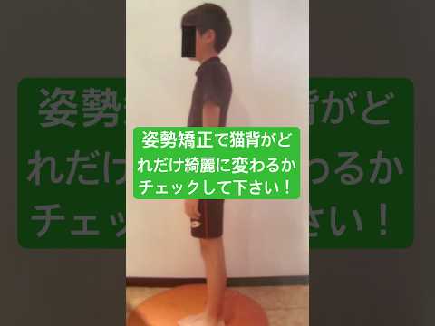 あっ！姿勢矯正で子供の猫背を改善しよう！美容整体きらくや