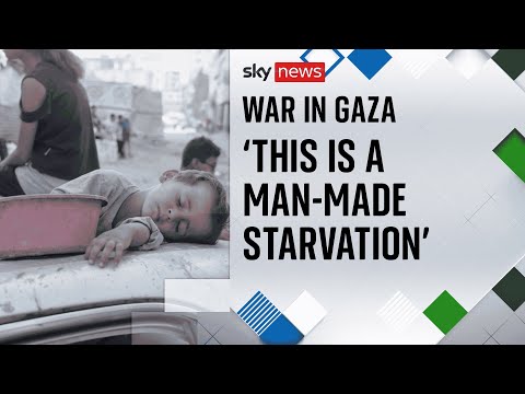 Inside Gaza's Nasser Hospital - where there's virtually no food for malnourished children