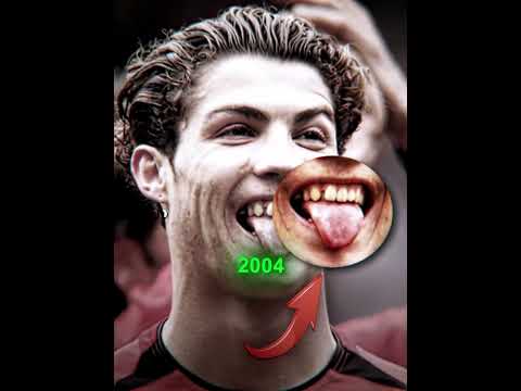 Ronaldo's Teeth Change 🥶
