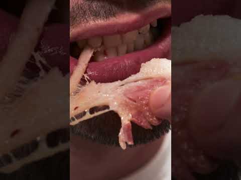 عدوى الديدان الشريطية تصيب الحيوان وحتى الإنسان