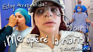 Todo lo que pasó en mi cirugía - Marian y YA! en Cartagena