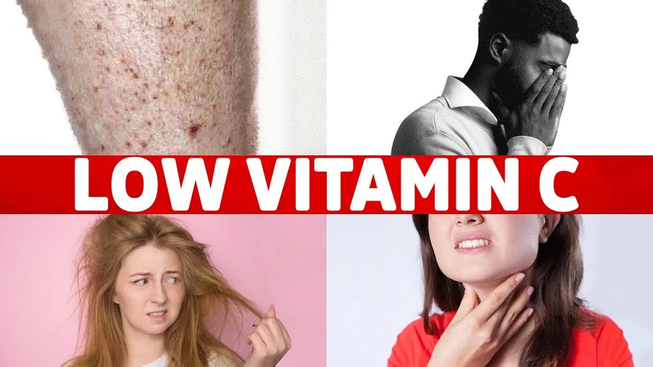 8 Signs of a Vitamin C Deficiency You’ve Never Heard About