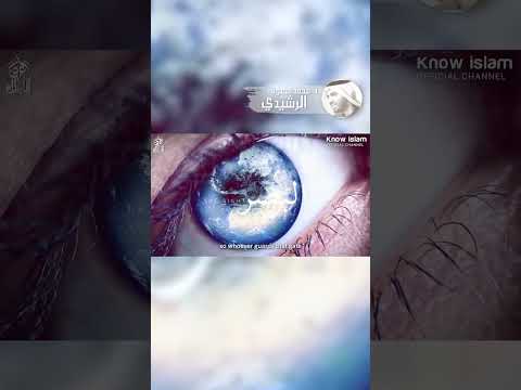 (أكبر بوابة للقلب) الدكتور محمد سعود الرشيدي