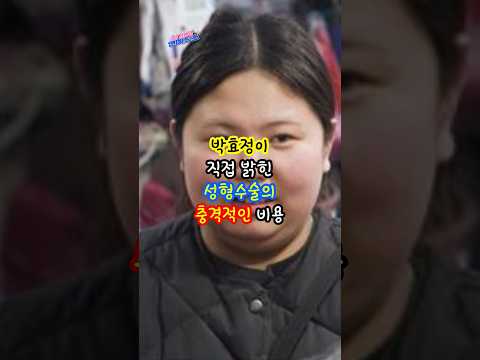 빅효정이 직접밝힌 성형수술의 충격적인 비용
