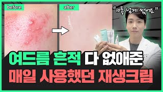 40대 동안 의사가 추천하는 가장 효과봤던 재생크림 5가지