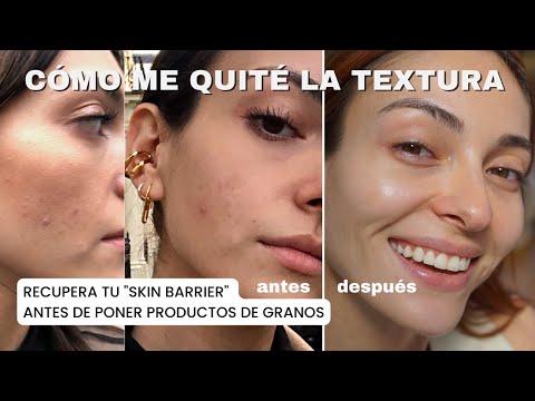 ¿Cómo quitar la textura de la piel? DETOX + RUTINA de skincare para eliminar textura | Anna Sarelly