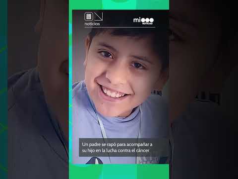 UN PADRE SE RAPÓ PARA ACOMPAÑAR A SU HIJO DURANTE EL TRATAMIENTO ONCOLÓGICO