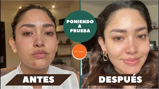 Poniendo a prueba sueros de Yanbal | Mich