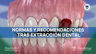 GUÍA completa tras EXTRACCIÓN dental - Evita complicaciones con estos CUIDADOS posexodoncia ©