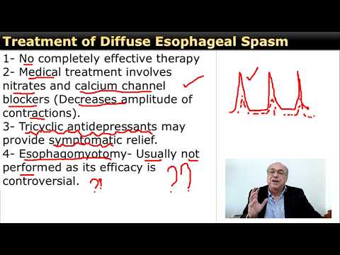 Diffuse Esophageal Spasm