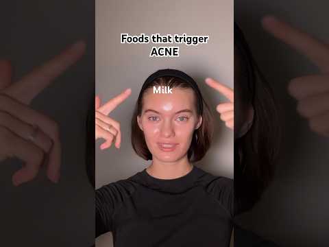 Avoid these if you have ACNE??? (just try to consume less??) #acne #acnetreatment #acnetips