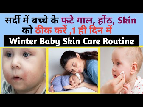 बच्चों की फटे गाल और त्वचा की देखभाल कैसे करें | Baby Skin Care | Parenting India